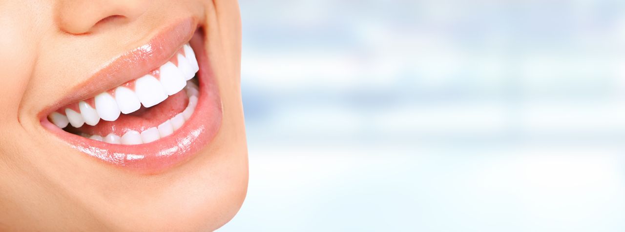 Implantologia i wybielanie zębów – koszta i zalety